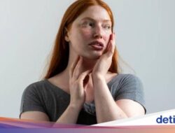 Penyakit Lupus: Tanda, Penyebab, Jenis, hingga Perawatannya