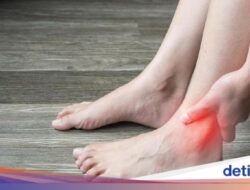 9 Konsumsi Pantangan agar Asam Urat Nggak Kumat