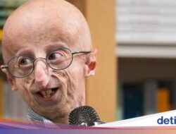 Dialami Sammy Basso, Kenali Penyakit Progeria yang Bikin Pengidapnya Tua Sebelum Lahir